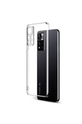 Mey İthalat® Redmi Note 11 Pro Plus 5G Kılıf Lüx Şeffaf Silikon