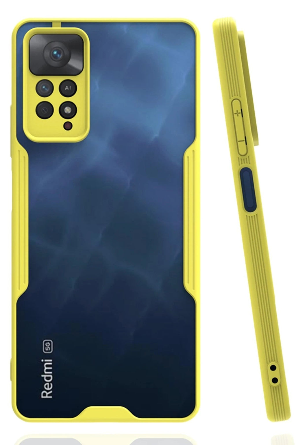 Mey İthalat® Redmi Note 11 Pro Kılıf Platin Silikon - Sarı